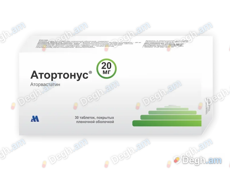 Ատորտոնուս